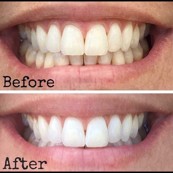 AP 24 Whitening Toothpaste - Picture 2 of 2